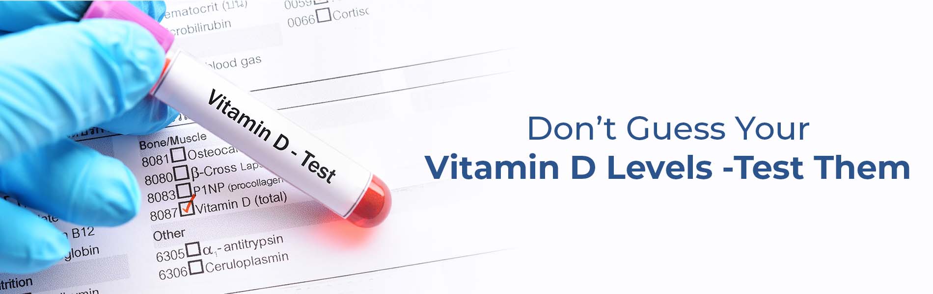Why Should You Book a Vitamin D Test Now?